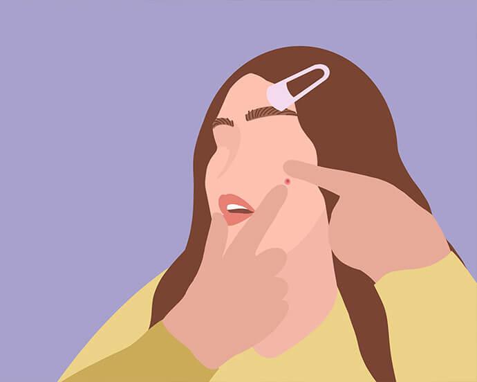 An illustration of a  woman with brown hair adorned with a hair clip is pinching a pimple on her face against a purple background and is wearing a yellow cardigan
