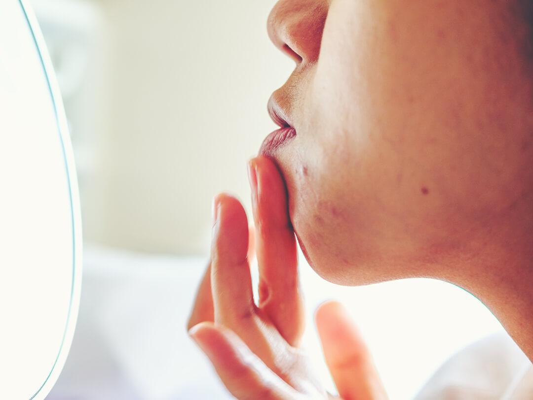 Close-up of a woman with acne checking herself in the mirror Desktop