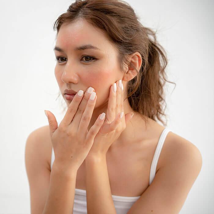 Woman with a thoughtful expression, touching her slightly reddened cheeks indicating inflammation, the soft lighting and natural background draw attention to her skin condition Mobile