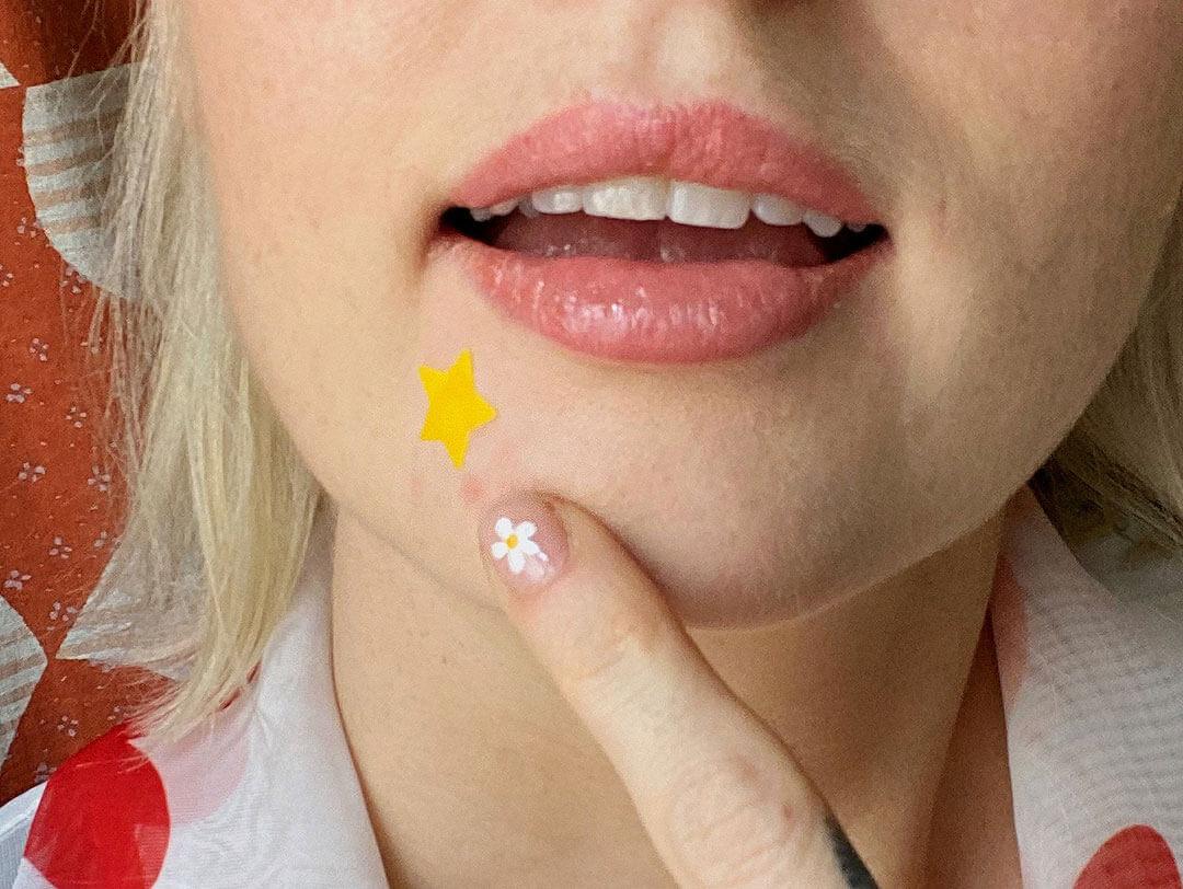Woman with a star-shaped pimple patch on her face, touching it gently with a finger adorned with daisy nail art Desktop