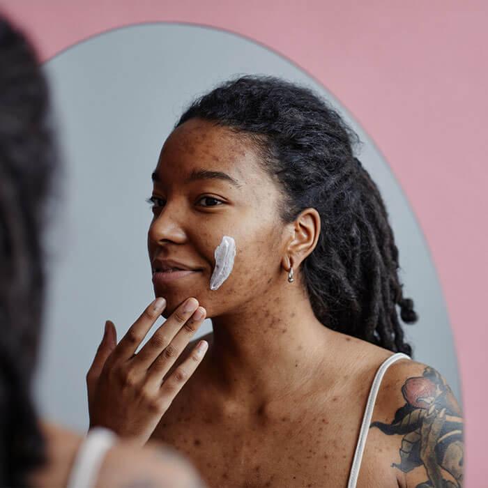A young black woman with visible acne is seen applying a retinol-based cream to her cheek in front of a mirror, illustrating a dermatologist-recommended skincare practice for acne Mobile