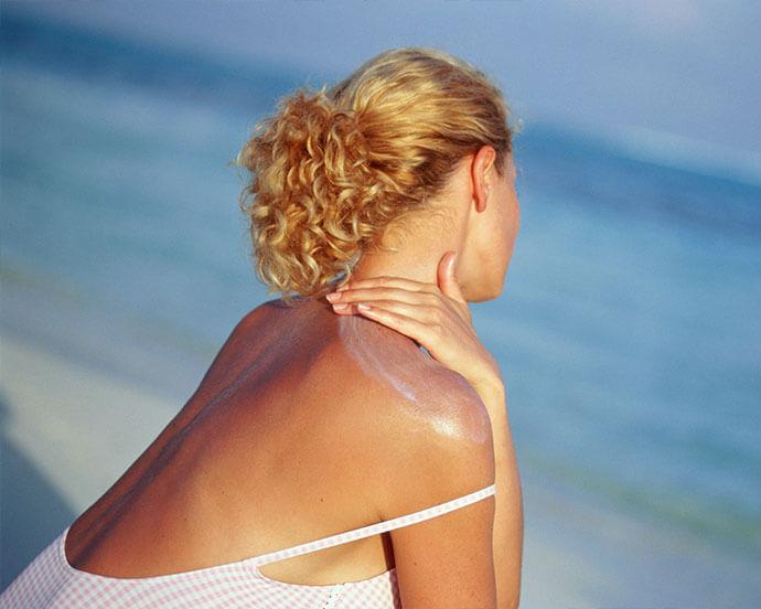 how-long-does-sunburn-last-header