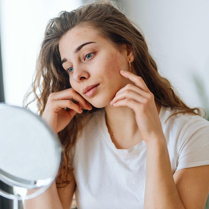 Young woman with problem skin looking into mirror.