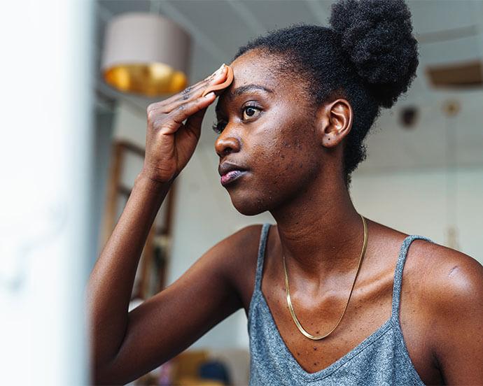 how-to-get-rid-of-cystic-acne-header