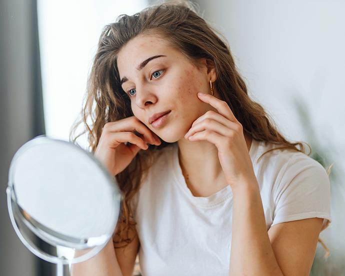 Young woman with problem skin looking into mirror.