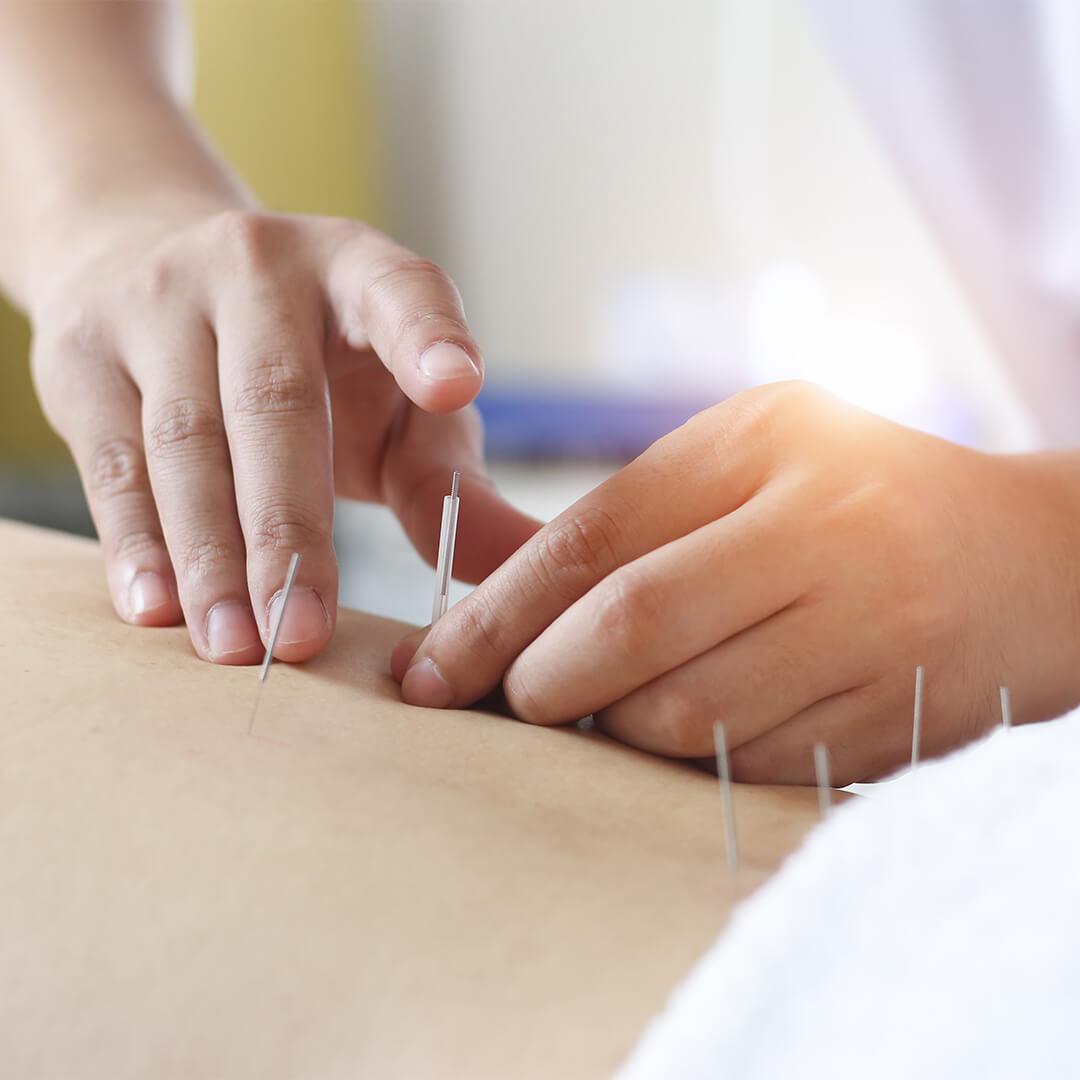 Traditional Chinese Acupuncture Desktop