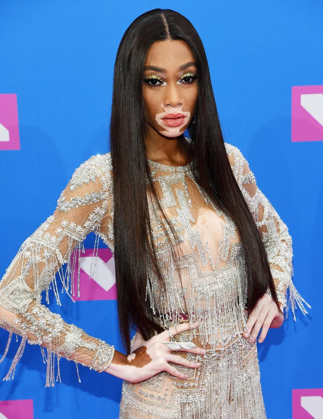 Winnie Harlow with long, straight hair posing Desktop