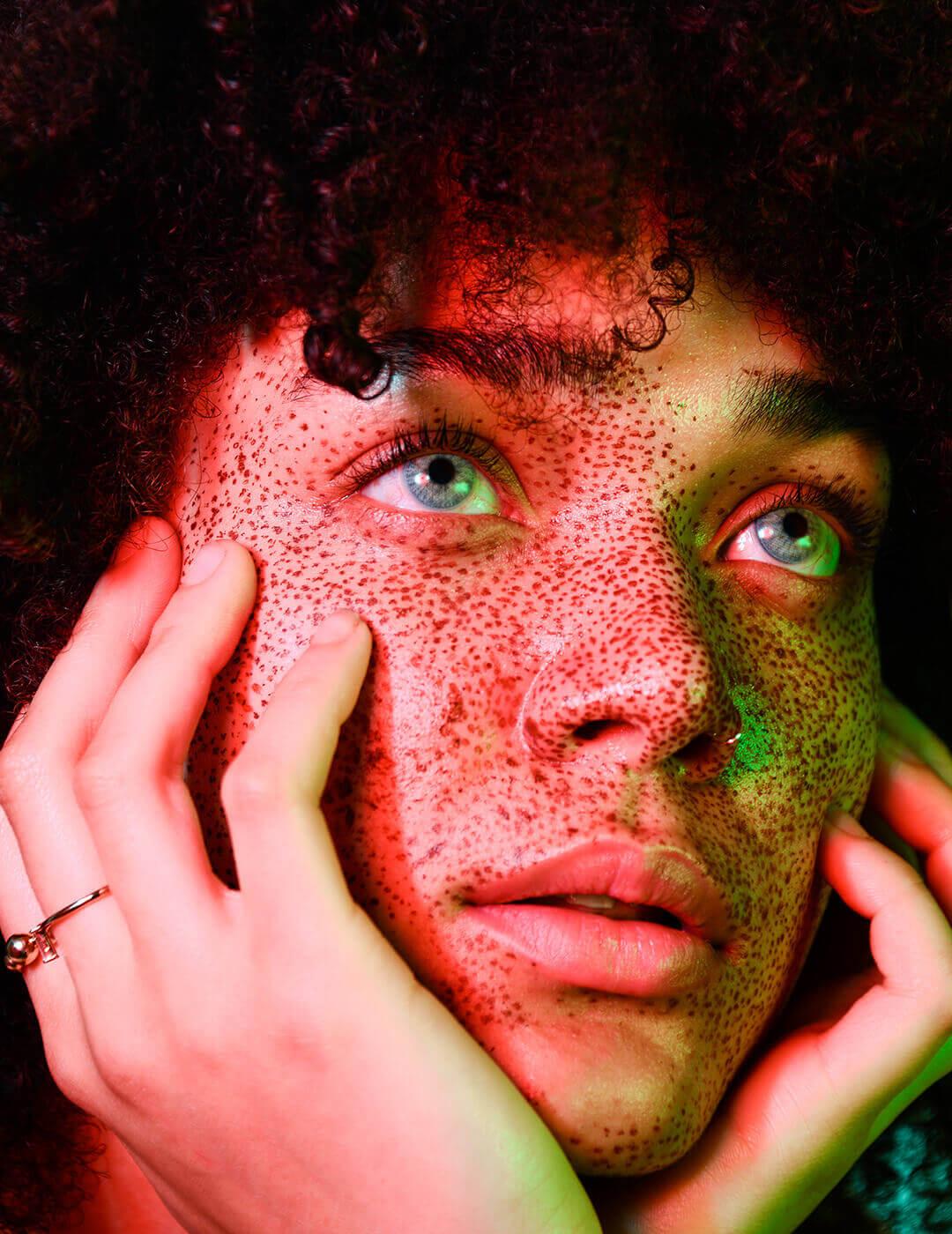A close-up image of a woman showcases her skin enhanced with radiofrequency micro needling looking confident with the freckles on her face, compliments her look with curly hair, blue eyes and a golden ring adorning her fingers Desktop