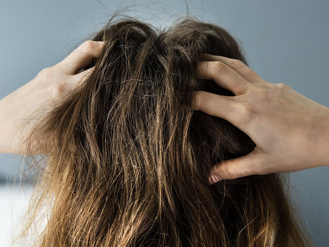 A closeup photo of a model's hair scratching and itching scalp Desktop