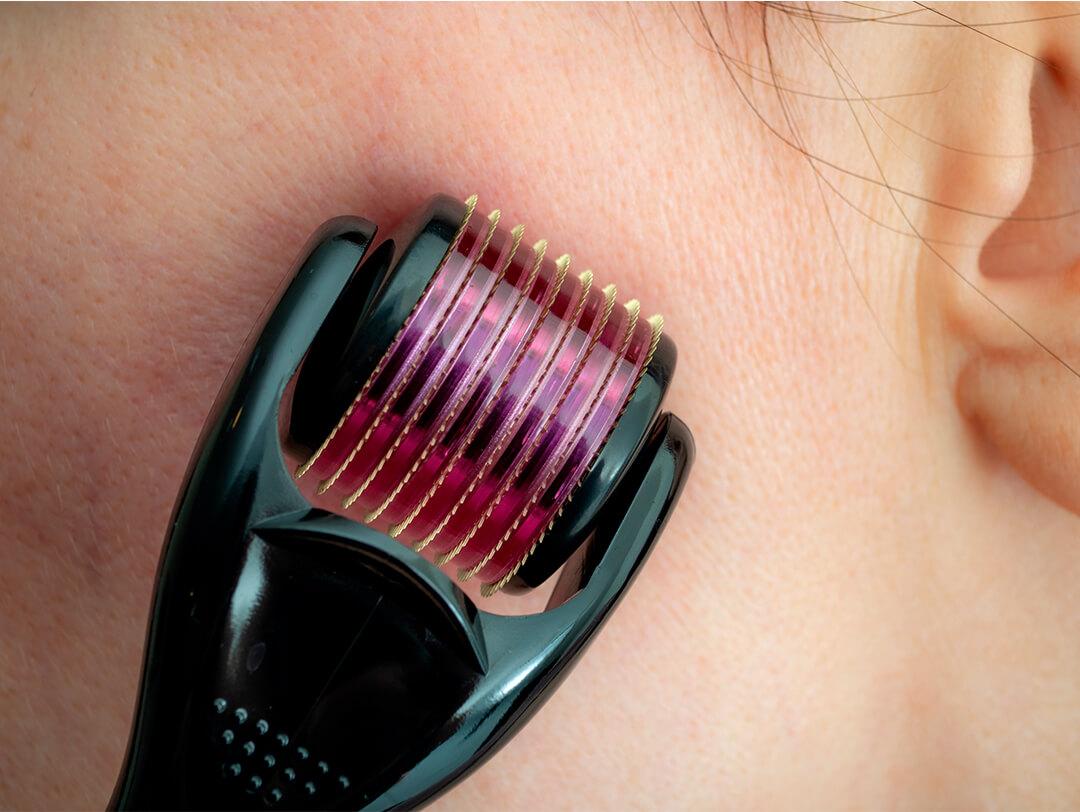Close-up image of a dermaroller on a woman's cheek Desktop
