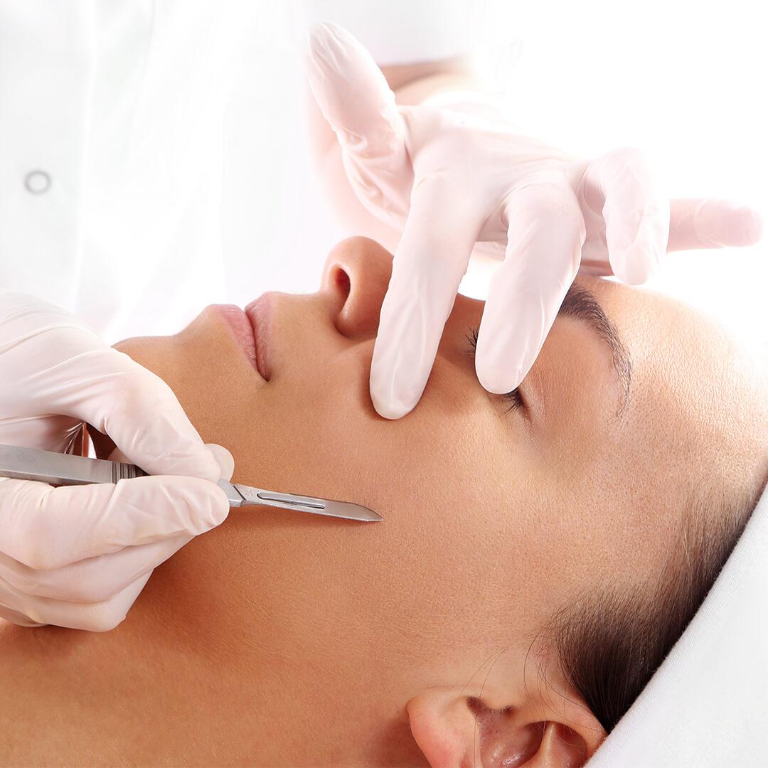 Close-up image of esthetician's hands dermaplaning a woman's face Mobile