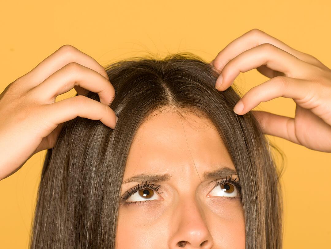 Photo of a model's head showing an itchy scalp on a yellow background Desktop